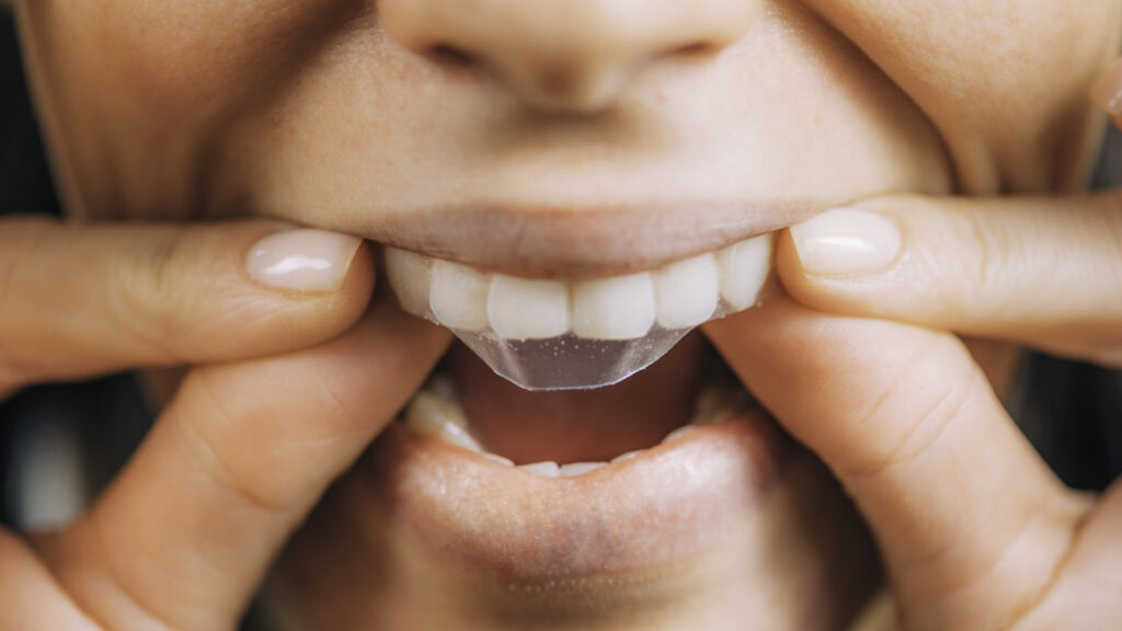 Whiten teeth at home with strips